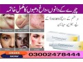 contractubex-gel-price-in-pakistan-03002478222-small-1