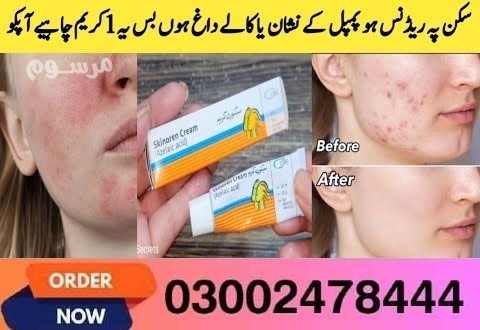 skinoren-cream-in-pakistan-03002478444-big-0