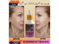 anti-pigmentation-face-serum-in-pakistan-03002478444-small-0